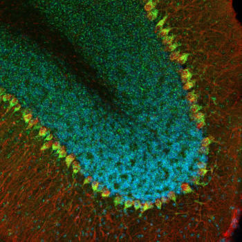 zunge_cerebellum_merged zunge_cerebellum_merged
